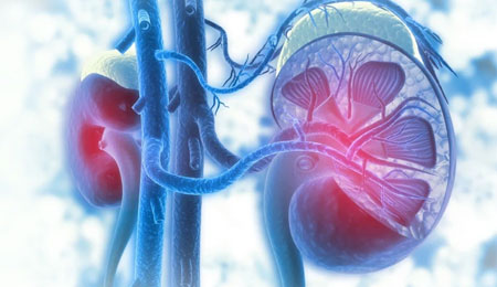 Acute Kidney Injury