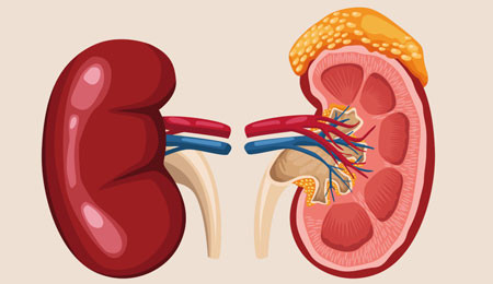 Glomerulonephritis