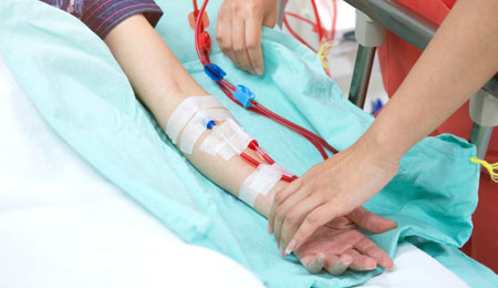 Vascular Access for Hemodialysis