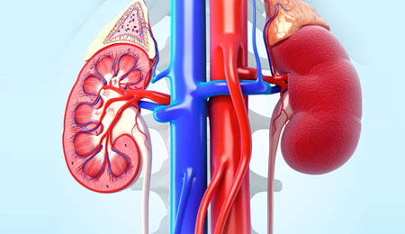 Diabetic Kidney Disease
